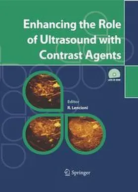 Lencioni |  Enhancing the Role of Ultrasound with Contrast Agents | Buch |  Sack Fachmedien