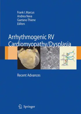 Marcus / Nava / Thiene | Arrhythmogenic RV Cardiomyopathy/Dysplasia | E-Book | sack.de