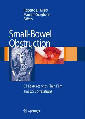 Scaglione / Di Mizio |  Small-Bowel Obstruction | Buch |  Sack Fachmedien