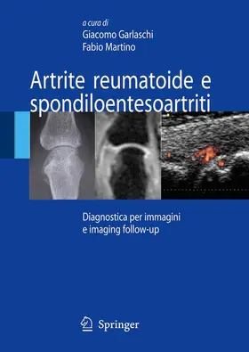 Martino / Garlaschi |  Artrite reumatoide e spondiloentesoartriti | Buch |  Sack Fachmedien