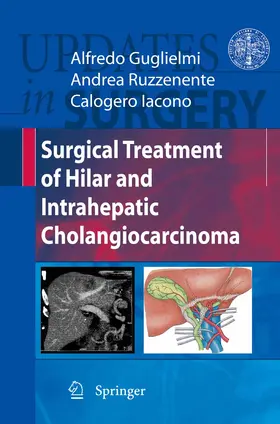 Guglielmi / Ruzzenente / Iacono |  Surgical Treatment of Hilar and Intrahepatic Cholangiocarcinoma | eBook | Sack Fachmedien