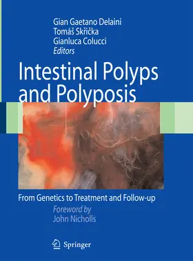 Delaini / Skricka / Sk?i?ka |  Intestinal Polyps and Polyposis | eBook | Sack Fachmedien