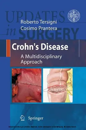 Tersigni / Prantera | Crohn's Disease | E-Book | sack.de
