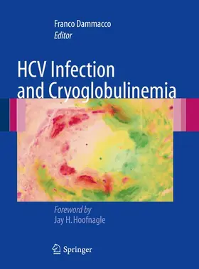 Dammacco |  HCV Infection and Cryoglobulinemia | Buch |  Sack Fachmedien