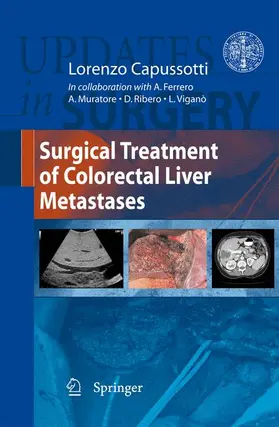 Capussotti |  Surgical Treatment of Colorectal Liver Metastases | Buch |  Sack Fachmedien