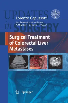 Capussotti |  Surgical Treatment of Colorectal Liver Metastases | eBook | Sack Fachmedien
