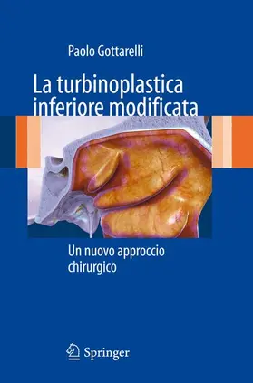 Gottarelli |  La Turbinoplastica Inferiore Modificata | Buch |  Sack Fachmedien