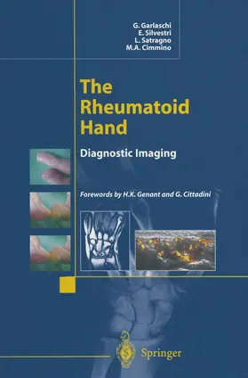 Garlaschi / Silvestri / Satragno |  The Rheumatoid Hand | Buch |  Sack Fachmedien