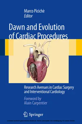 Picichè | Dawn and Evolution of Cardiac Procedures | E-Book | www2.sack.de