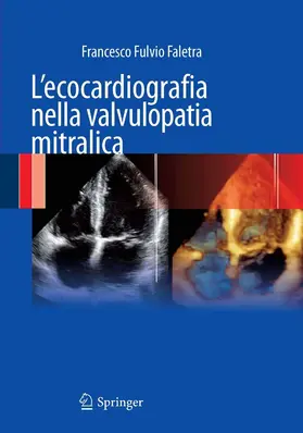 Faletra | L'ecocardiografia nella valvulopatia mitralica | E-Book | sack.de