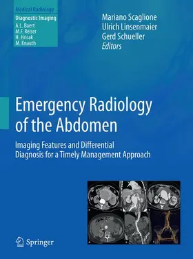Scaglione / Linsenmaier / Schueller | Emergency Radiology of the Abdomen | Buch | 978-88-470-3912-4 | sack.de