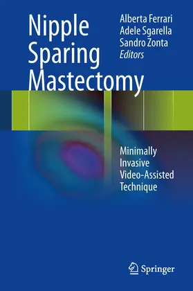 Ferrari / Sgarella / Zonta |  Nipple Sparing Mastectomy | eBook | Sack Fachmedien