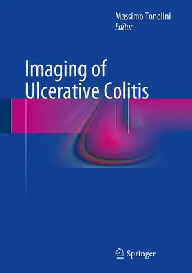 Tonolini |  Imaging of Ulcerative Colitis | Buch |  Sack Fachmedien