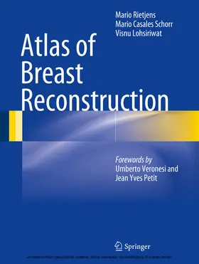 Rietjens / Casales Schorr / Lohsiriwat |  Atlas of Breast Reconstruction | eBook | Sack Fachmedien