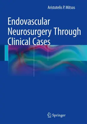 Mitsos |  Endovascular Neurosurgery Through Clinical Cases | Buch |  Sack Fachmedien