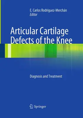 Rodrìguez-Merchán |  Articular Cartilage Defects of the Knee | Buch |  Sack Fachmedien