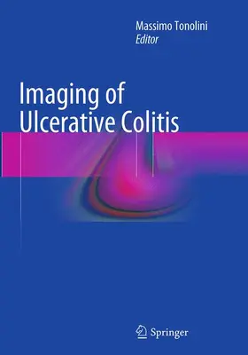 Tonolini |  Imaging of Ulcerative Colitis | Buch |  Sack Fachmedien