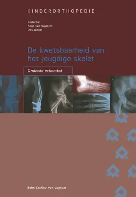 Winkel / van Nugteren |  De kwetsbaarheid van het jeugdige skelet: onderste extremiteit | Buch |  Sack Fachmedien