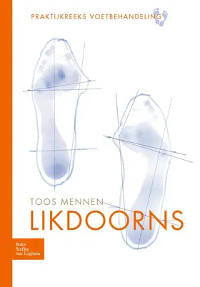 Mennen |  Likdoorns | Buch |  Sack Fachmedien
