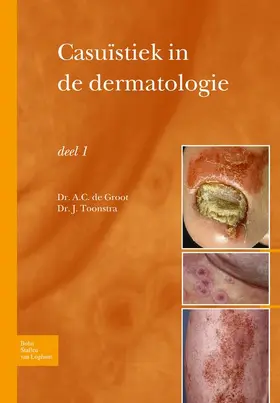 Groot / Toonstra |  Casuïstiek in de Dermatologie - Deel I | Buch |  Sack Fachmedien