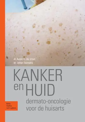 Groot / Toonstra |  Kanker en huid | eBook | Sack Fachmedien