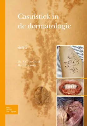 Toonstra |  Casuïstiek in de Dermatologie - Deel 2 | Buch |  Sack Fachmedien
