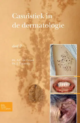 Toonstra |  Casuïstiek in de dermatologie - deel 2 | eBook | Sack Fachmedien