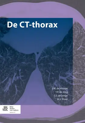 Hosson / de Jong / de Jonge |  De CT-thorax | Buch |  Sack Fachmedien