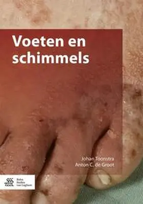 Toonstra / de Groot |  Voeten en schimmels | Buch |  Sack Fachmedien