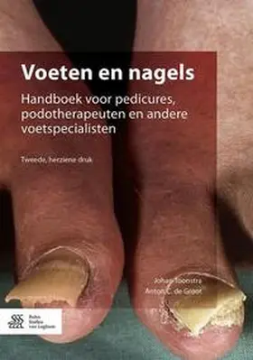 Toonstra |  Voeten en nagels | Buch |  Sack Fachmedien