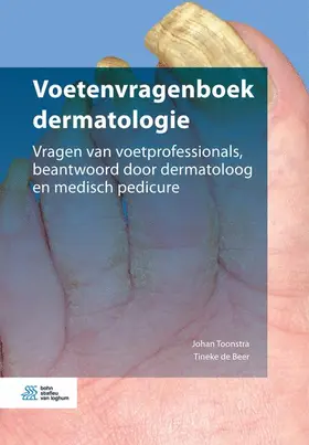 de Beer / Toonstra |  Voetenvragenboek dermatologie | Buch |  Sack Fachmedien