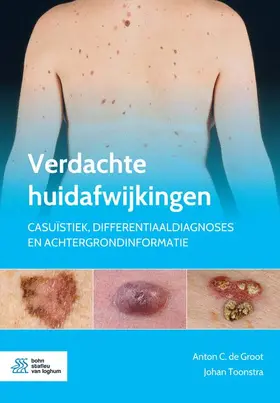 Toonstra / de Groot |  Verdachte huidafwijkingen | Buch |  Sack Fachmedien