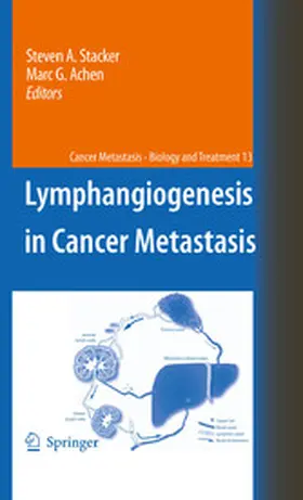 Stacker / Achen | Lymphangiogenesis in Cancer Metastasis | E-Book | www2.sack.de