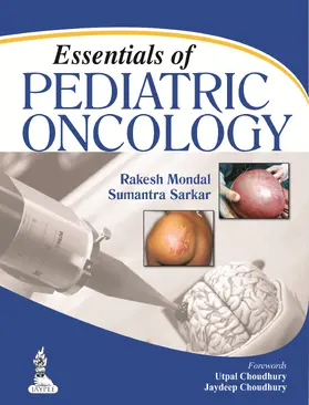 Mondal / Sarkar |  Essentials of Pediatric Oncology | Buch |  Sack Fachmedien