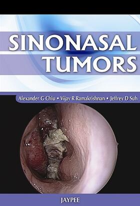 Chiu / Ramakrishnan / Suh |  Sinonasal Tumors | Buch |  Sack Fachmedien