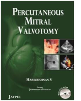 Harikrishnan |  Percutaneous Mitral Valvotomy | Buch |  Sack Fachmedien