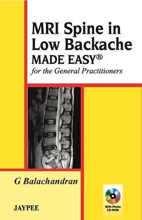 Balachandran |  MRI Spine in Low Backache Made Easy | Buch |  Sack Fachmedien