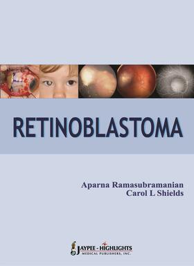 Ramasubramanian / Shields |  Retinoblastoma | Buch |  Sack Fachmedien