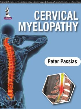 Passias |  Cervical Myelopathy | Buch |  Sack Fachmedien