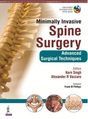 Singh / Vaccaro |  Minimally Invasive Spine Surgery | Buch |  Sack Fachmedien