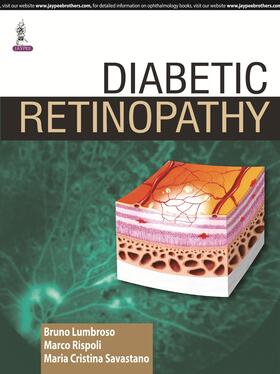 Lumbroso / Rispoli / Savastano |  Diabetic Retinopathy | Buch |  Sack Fachmedien