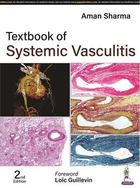 Sharma |  Textbook of Systemic Vasculitis | Buch |  Sack Fachmedien