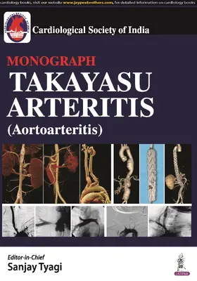 Tyagi / Roy / Joseph |  Takayasu Arteritis (Aortoarteritis) | Buch |  Sack Fachmedien