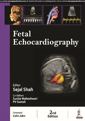 Shah / Maheshwari / Suresh |  Fetal Echocardiography | Buch |  Sack Fachmedien