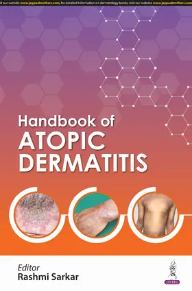 Sarkar |  Handbook of Atopic Dermatitis | Buch |  Sack Fachmedien