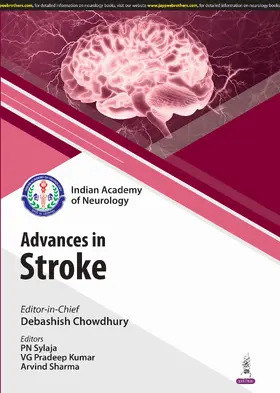 Sharma / Chowdhury / Sylaja |  Recent Advances in Stroke | Buch |  Sack Fachmedien