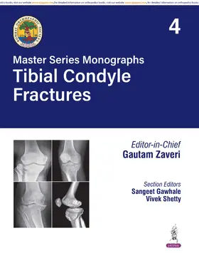 Zaveri / Gawhale / Shetty |  Master Series Monographs: Tibial Condyle Fractures | Buch |  Sack Fachmedien
