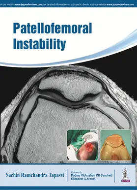 Tapasvi |  Patellofemoral Instability | Buch |  Sack Fachmedien