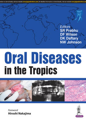 Prabhu / Wilson / Daftary |  Oral Diseases in the Tropics | Buch |  Sack Fachmedien