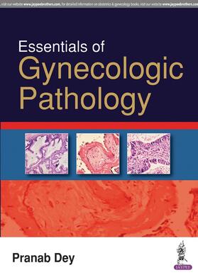 Dey |  ESSENTIALS OF GYNECOLOGIC PATHOLOGY | Buch |  Sack Fachmedien